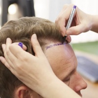 Kapan Rambut Yang Ditanam Kapan Tumbuh?